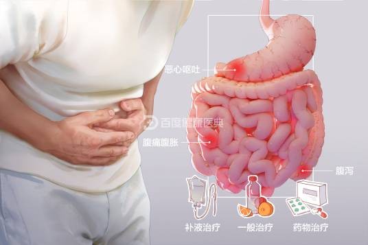 急性胃肠炎
