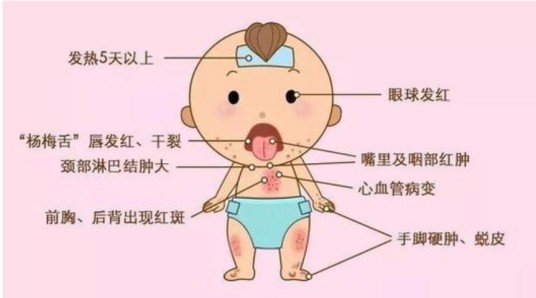 儿童怪病