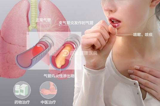 急性支气管炎