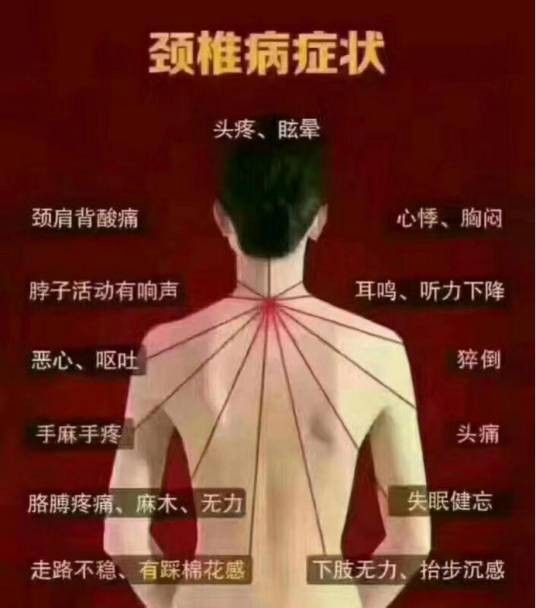 颈椎病的临床表现