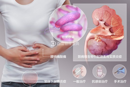 肾盂肾炎