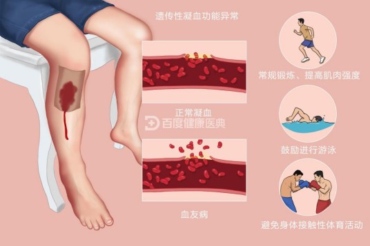 血友病