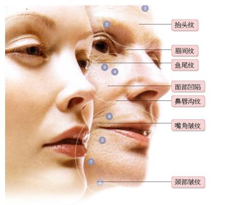 皱纹（汉语词汇）