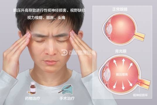 青光眼（疾病名称）