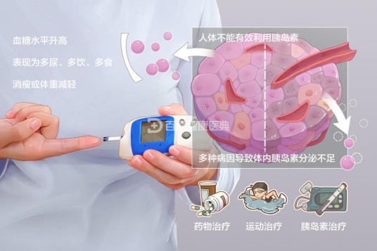 2型糖尿病