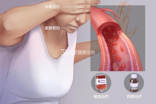 贫血(医学术语)