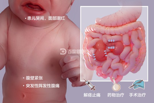 肠痉挛