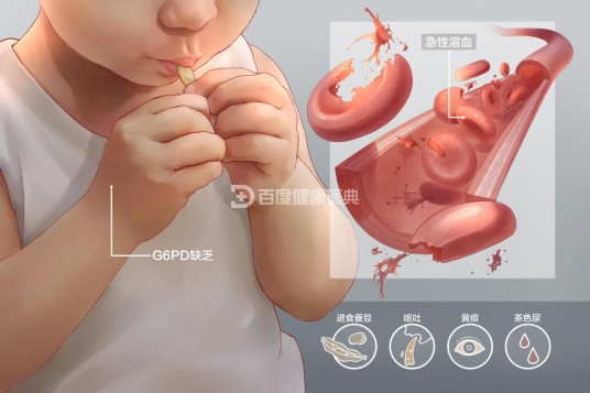 蚕豆病