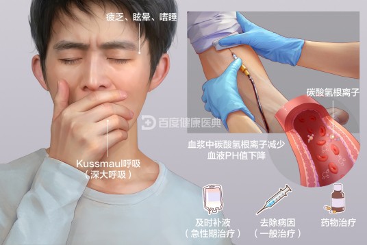 代谢性酸中毒