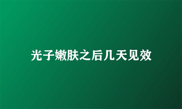光子嫩肤之后几天见效