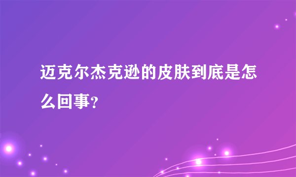 迈克尔杰克逊的皮肤到底是怎么回事？