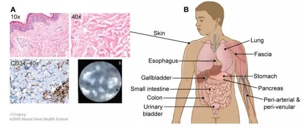 科学家在人体内发现未知新器官，人体究竟还有多秘密？