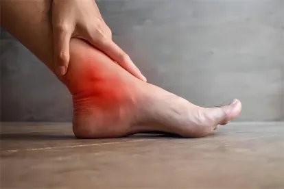 尿酸高症状图片大全