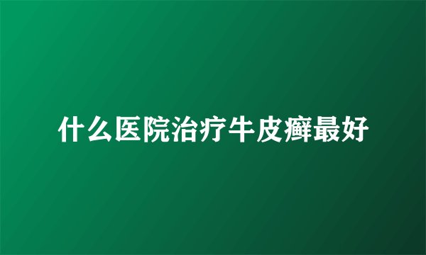 什么医院治疗牛皮癣最好
