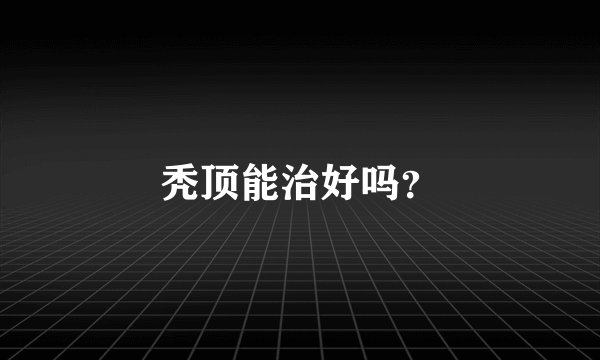 秃顶能治好吗？
