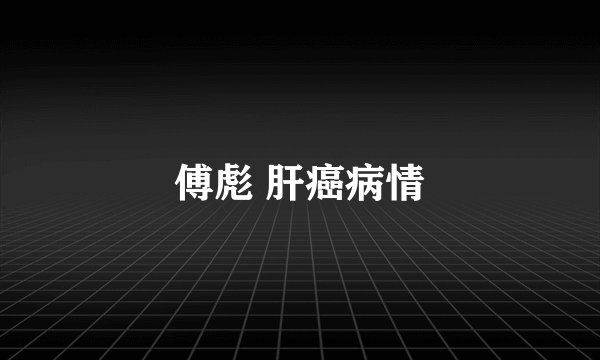 傅彪 肝癌病情