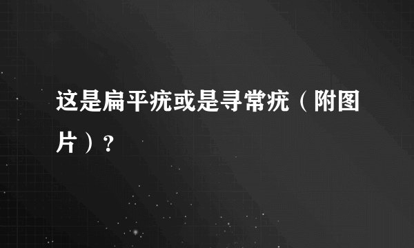这是扁平疣或是寻常疣（附图片）？