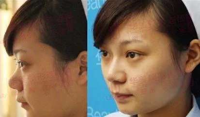 华东医药怎么样?值得长期(十年以上)投资吗?