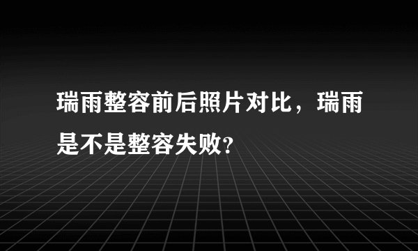 瑞雨整容前后照片对比，瑞雨是不是整容失败？