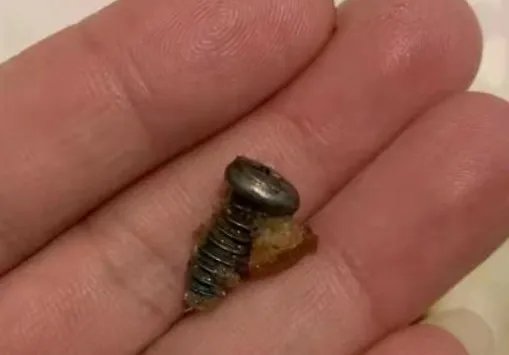 河南一男子吃月饼咬到螺丝磕坏2颗牙,厂商是否需要赔偿?