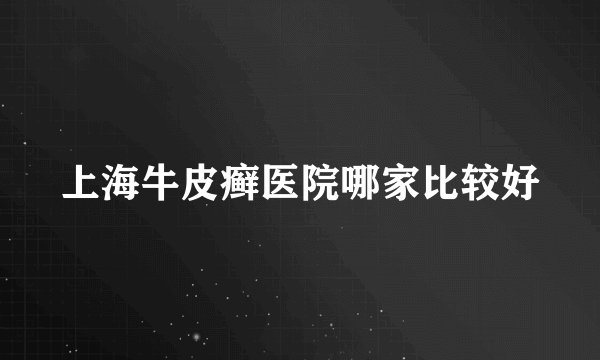 上海牛皮癣医院哪家比较好