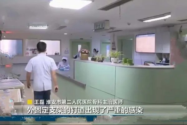 小伙身高不足一米八断骨增高致残疾，男生没有一米八真的会受歧视吗？