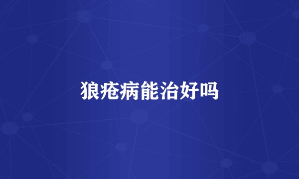 狼疮病能治好吗