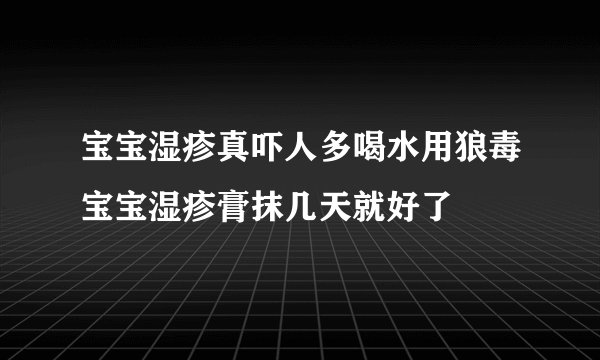 宝宝湿疹真吓人多喝水用狼毒宝宝湿疹膏抹几天就好了