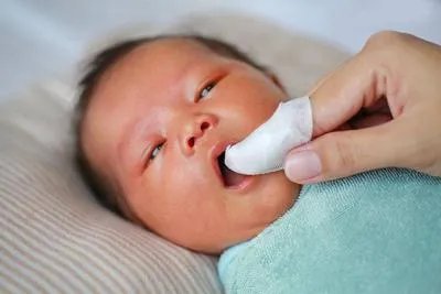 婴儿鹅口疮的护理方法有哪些 三步正确呵护婴儿鹅口疮