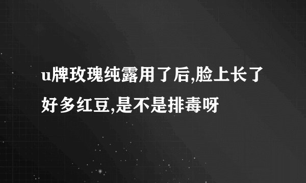 u牌玫瑰纯露用了后,脸上长了好多红豆,是不是排毒呀