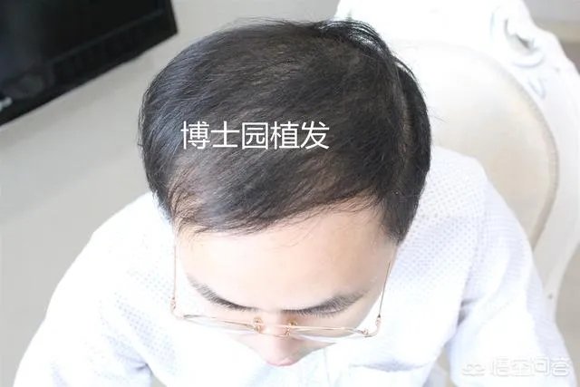 关于「男生自己吹头发技巧」，问问大家怎么看？
