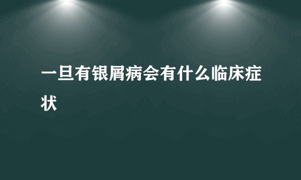 一旦有银屑病会有什么临床症状
