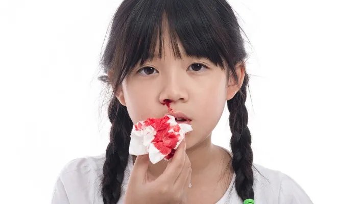 小儿鼻出血的原因