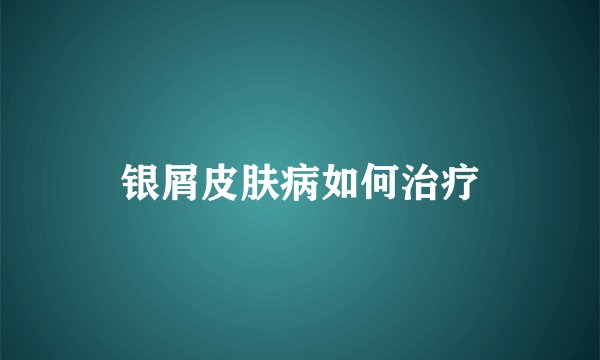 银屑皮肤病如何治疗