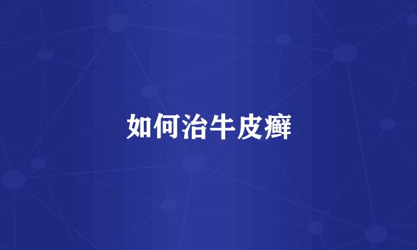 如何治牛皮癣
