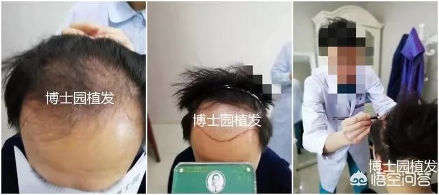 关于「男生自己吹头发技巧」,问问大家怎么看?