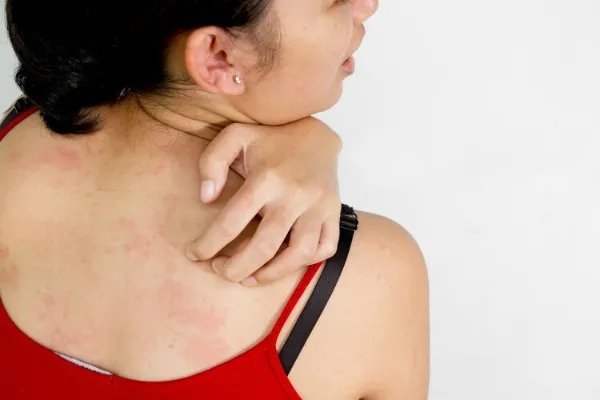 脸上的“招财痣”越长越大，原来是癌变信号？皮肤3个异常要留心