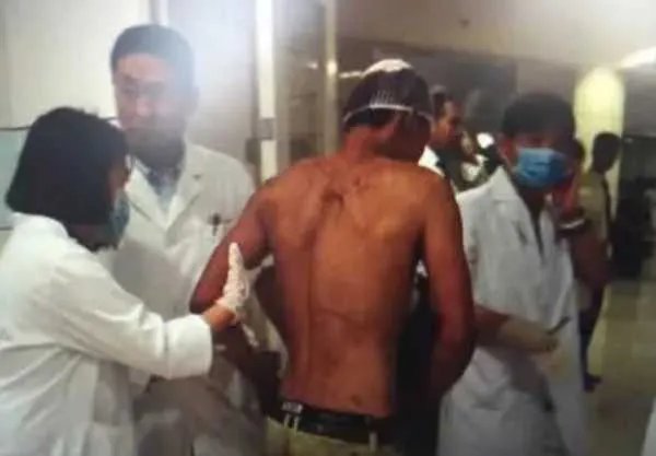 天津塘沽爆炸已过去五年,当初导致爆炸的原因是什么?