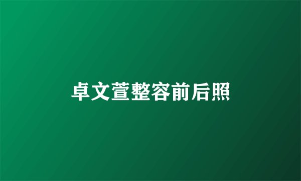 卓文萱整容前后照