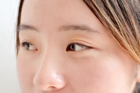 脸脱皮怎么办
