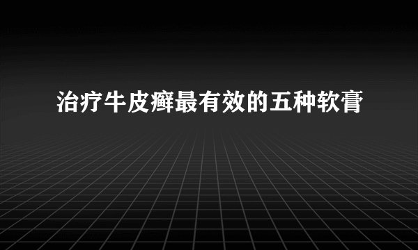 治疗牛皮癣最有效的五种软膏