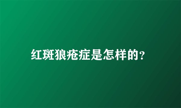 红斑狼疮症是怎样的？