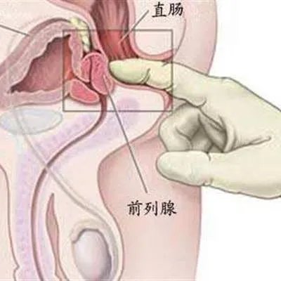男性可以吃什么补精
