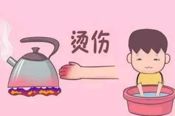 河北一女孩玩火碱重度烧伤,不小心烧伤第一时间该如何处理伤口?