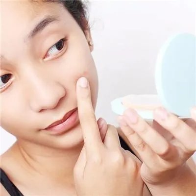 长痘痘是什么原因引起的