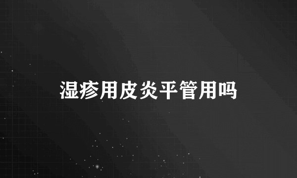 湿疹用皮炎平管用吗